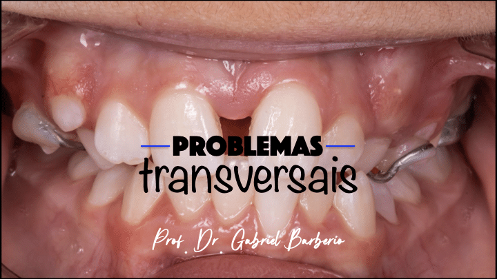 Imagem do módulo 05 - Problemas Transversais