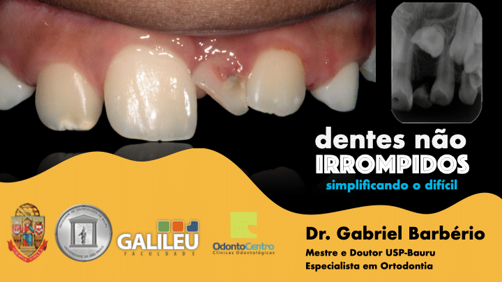 Imagem do módulo 08 - Dentes Retidos
