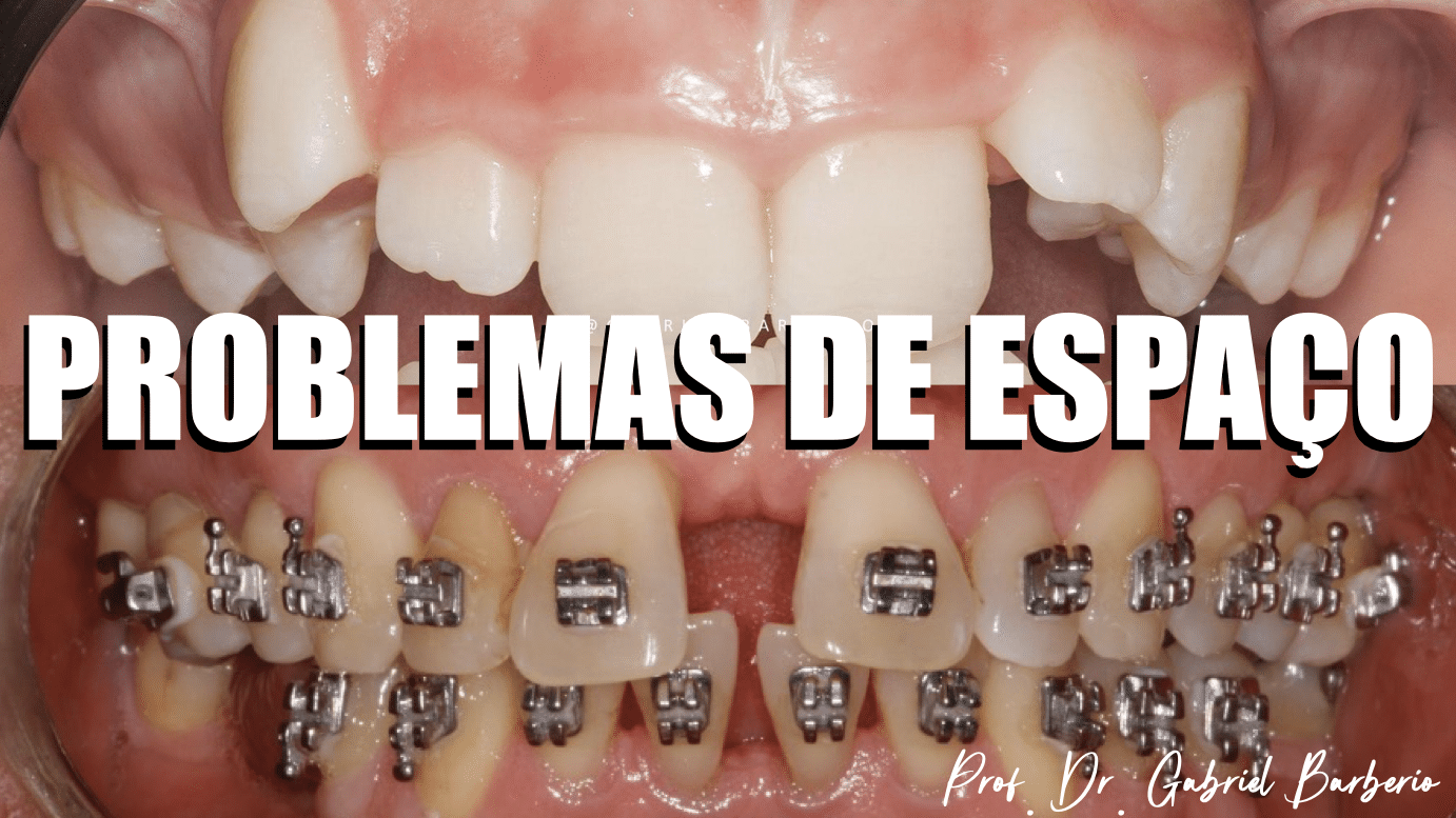 Imagem do módulo 04 - Problemas de Espaço