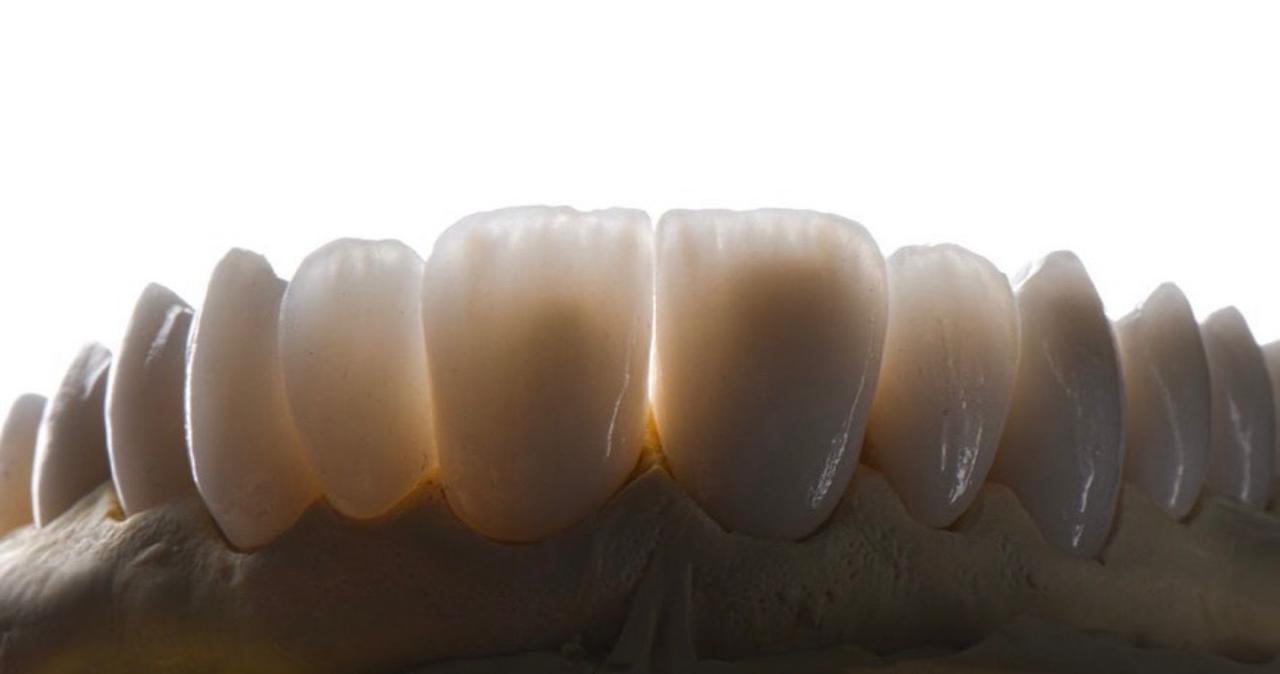 Prótese dental de alta qualidade produzida no laboratório